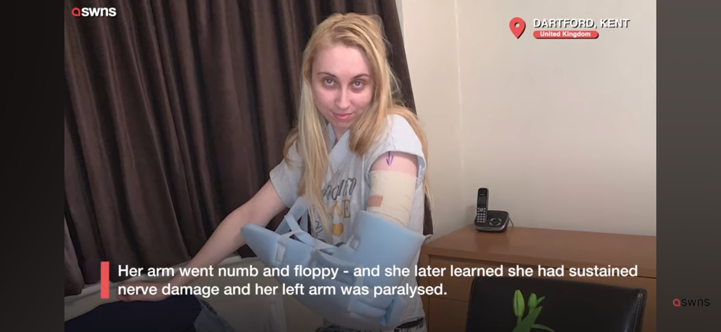 Une femme portant une attelle après avoir subi des dommages nerveux causés par un implant contraceptif.