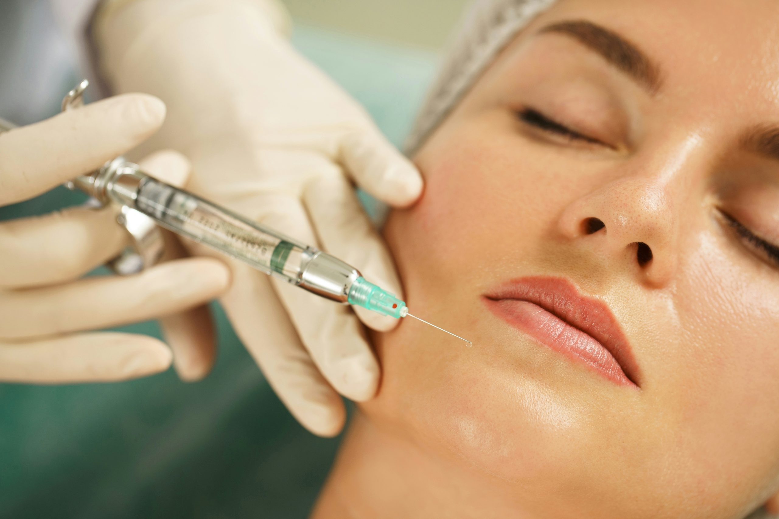 Injection d’acide hyaluronique ou de Botox sur le visage d’une patiente par un médecin esthétique portant des gants.