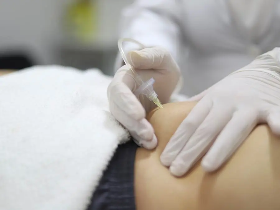 Séance de carboxythérapie avec injection de CO₂ dans la peau réalisée par un professionnel en institut esthétique.